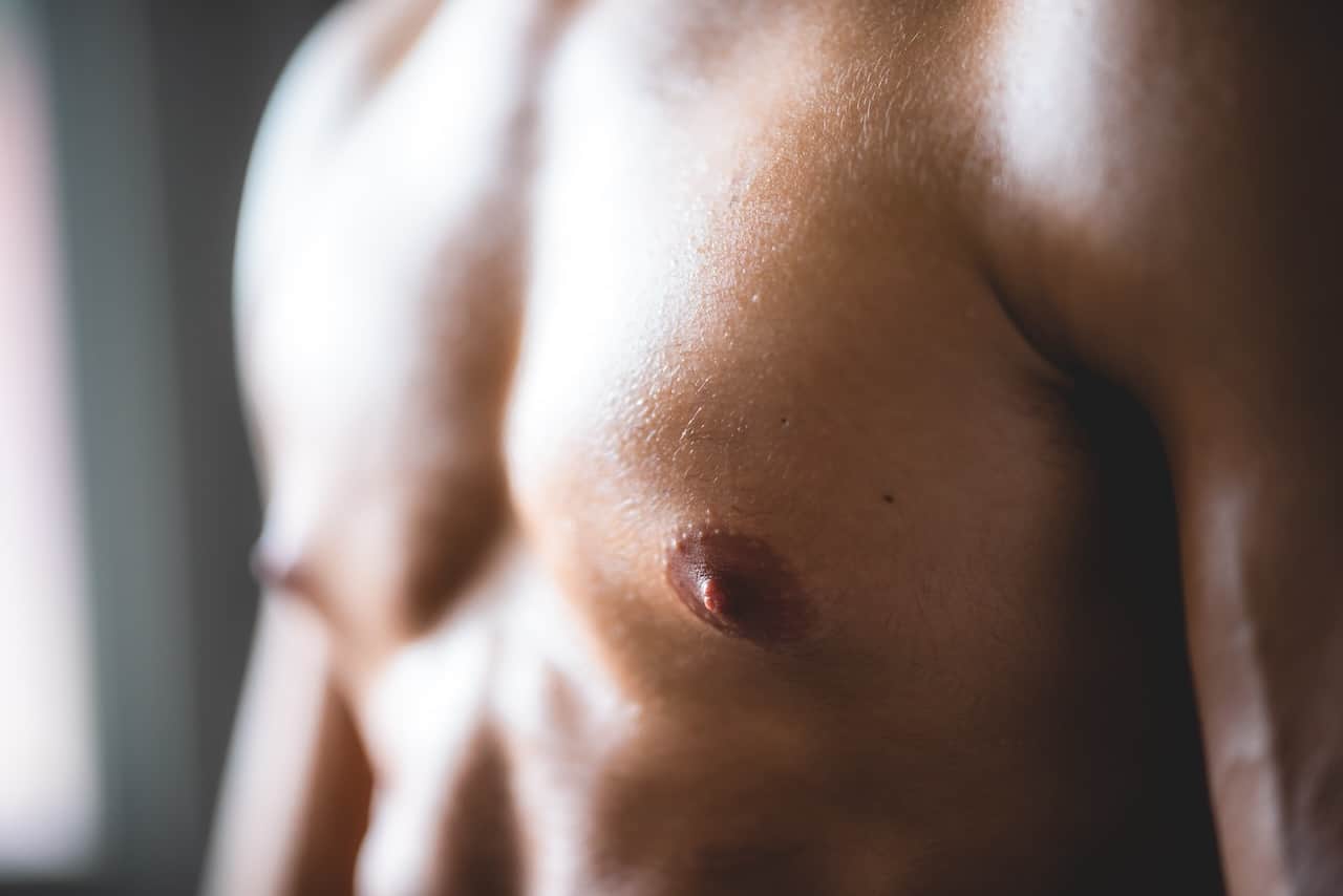 Adult Gynecomastia Surgery San Diego